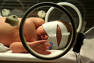 Neonatal jaundice — source media 3