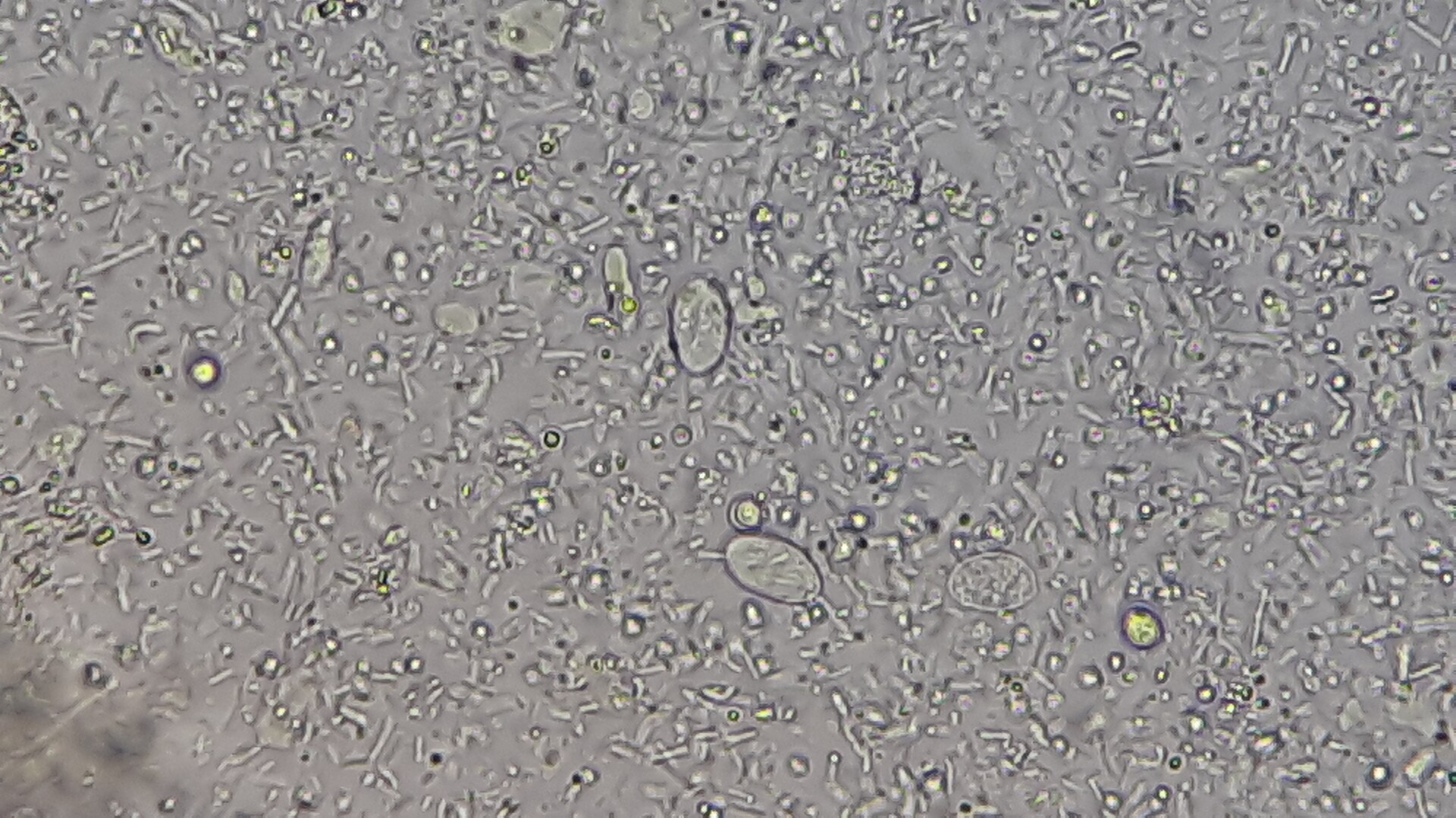 Giardia stool microscopy — source media 3