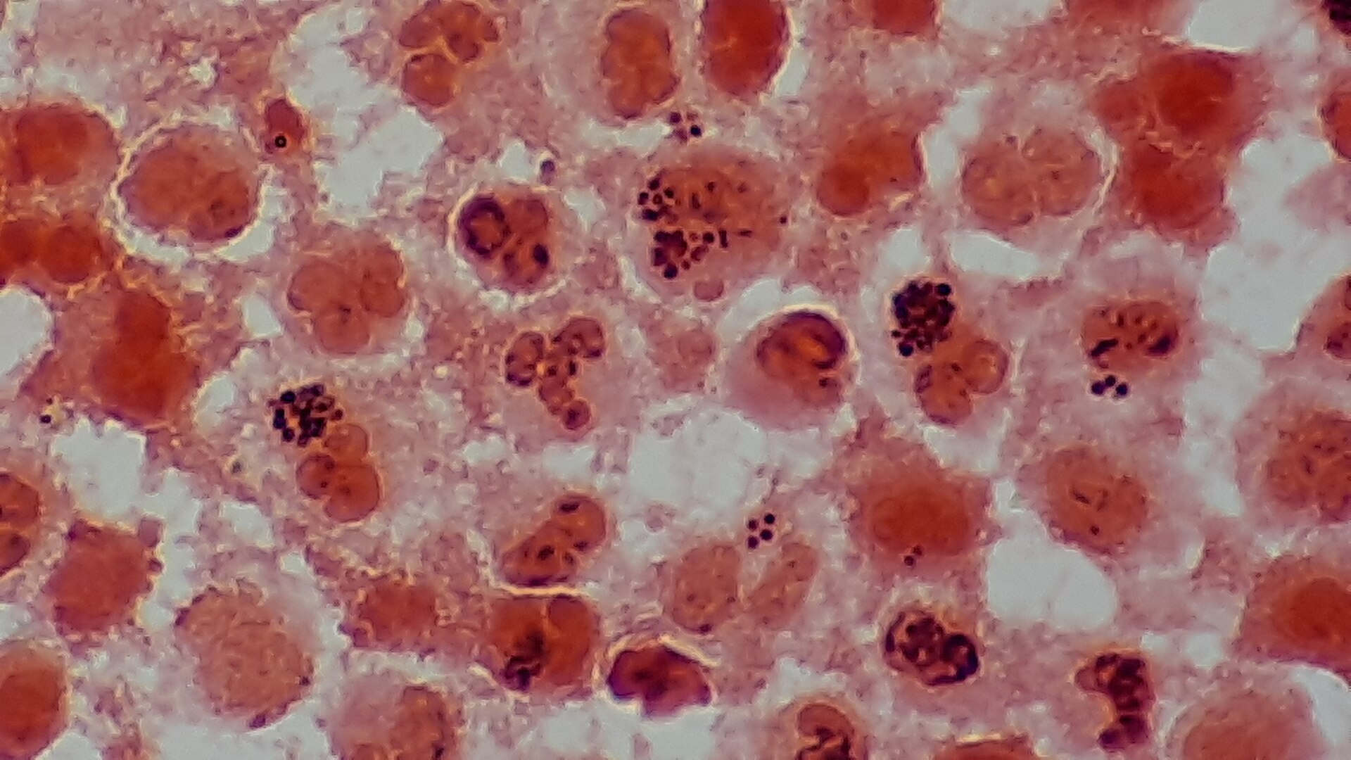 Gram positive cocci — source media 2
