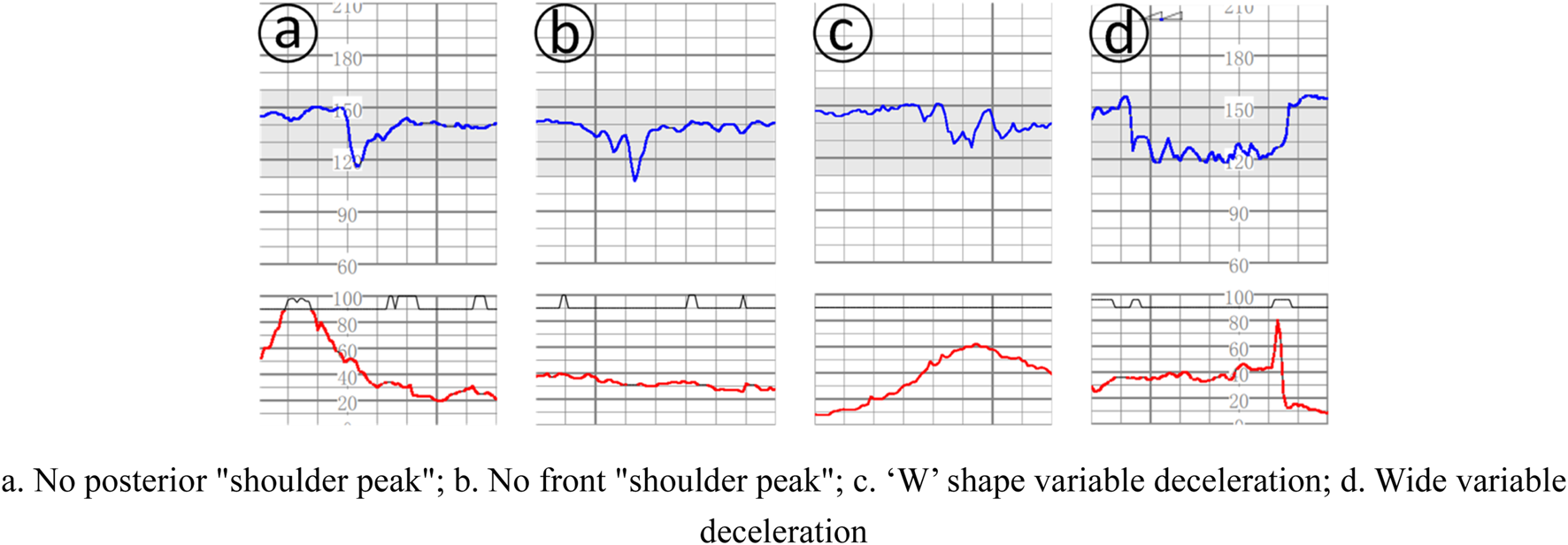Variable decelerations — source media 2