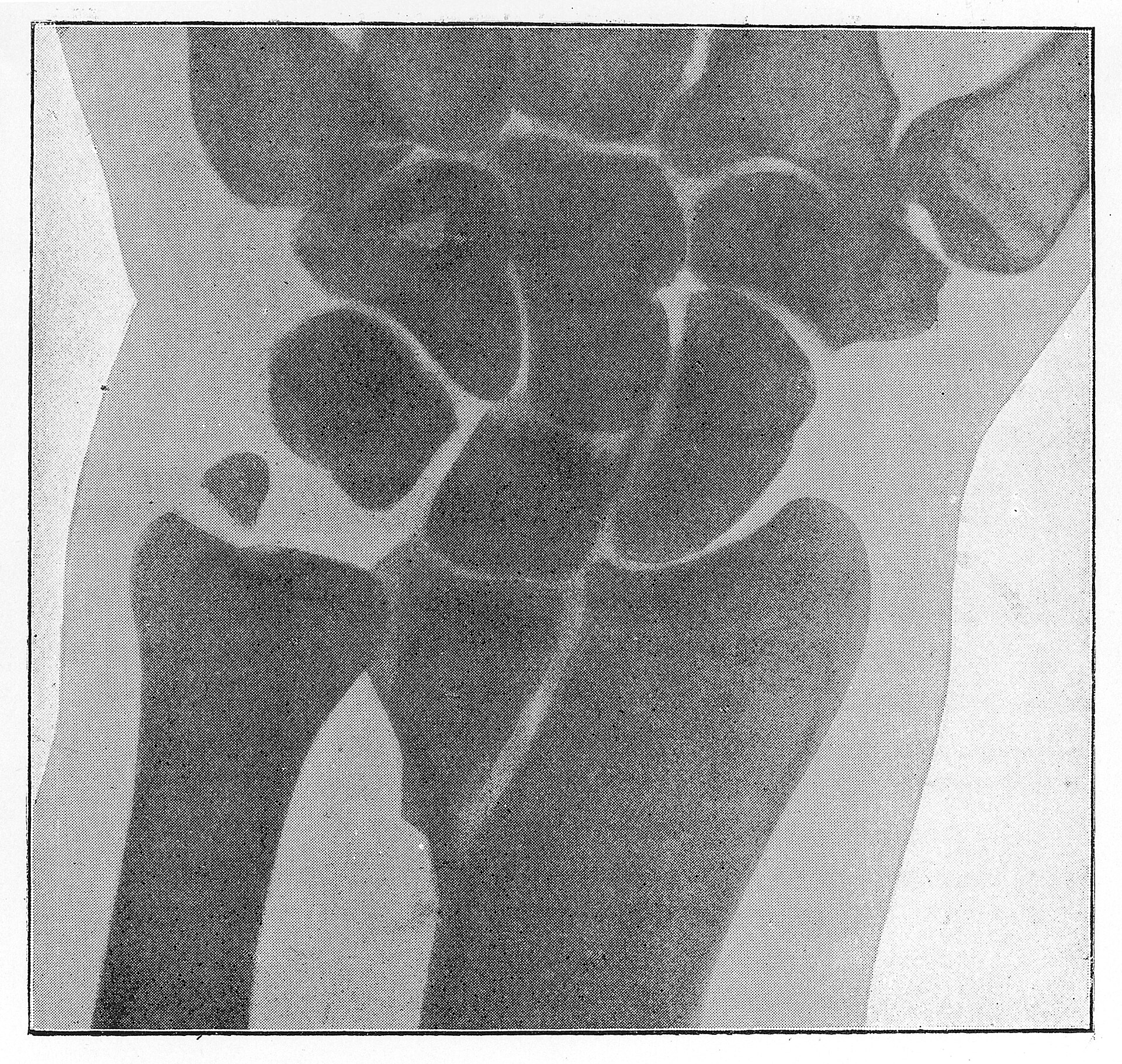 Colles fracture — source media 3