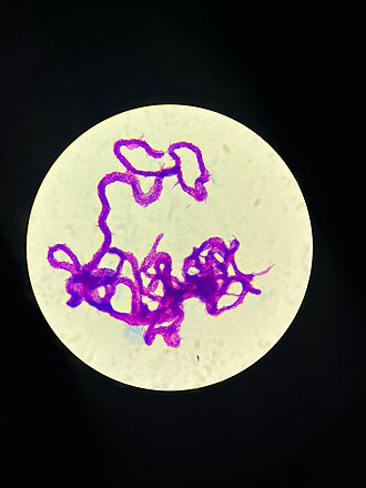 Acid fast bacilli — source media 3