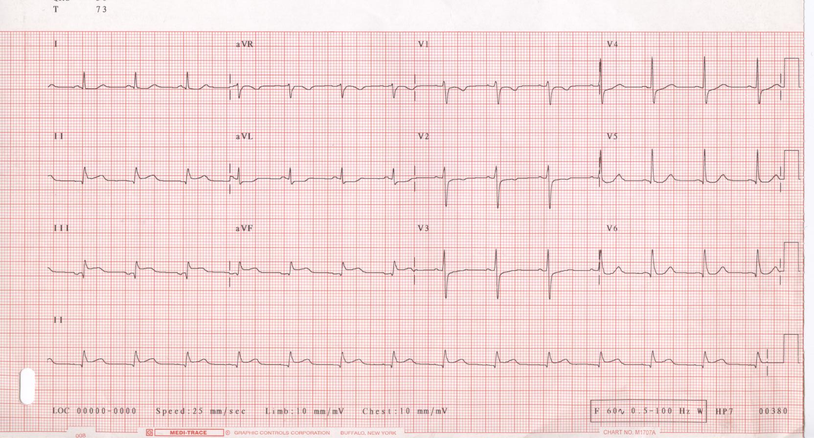 ECG 001.jpg — source media 2