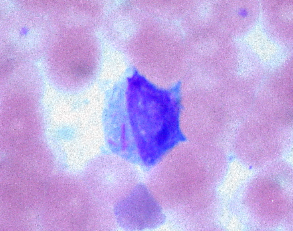 Auer rods AML — source media 2