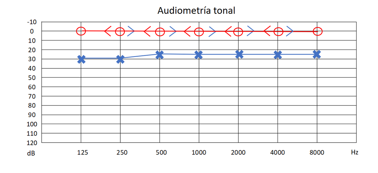 Hearing tests and audiograms — source media 3