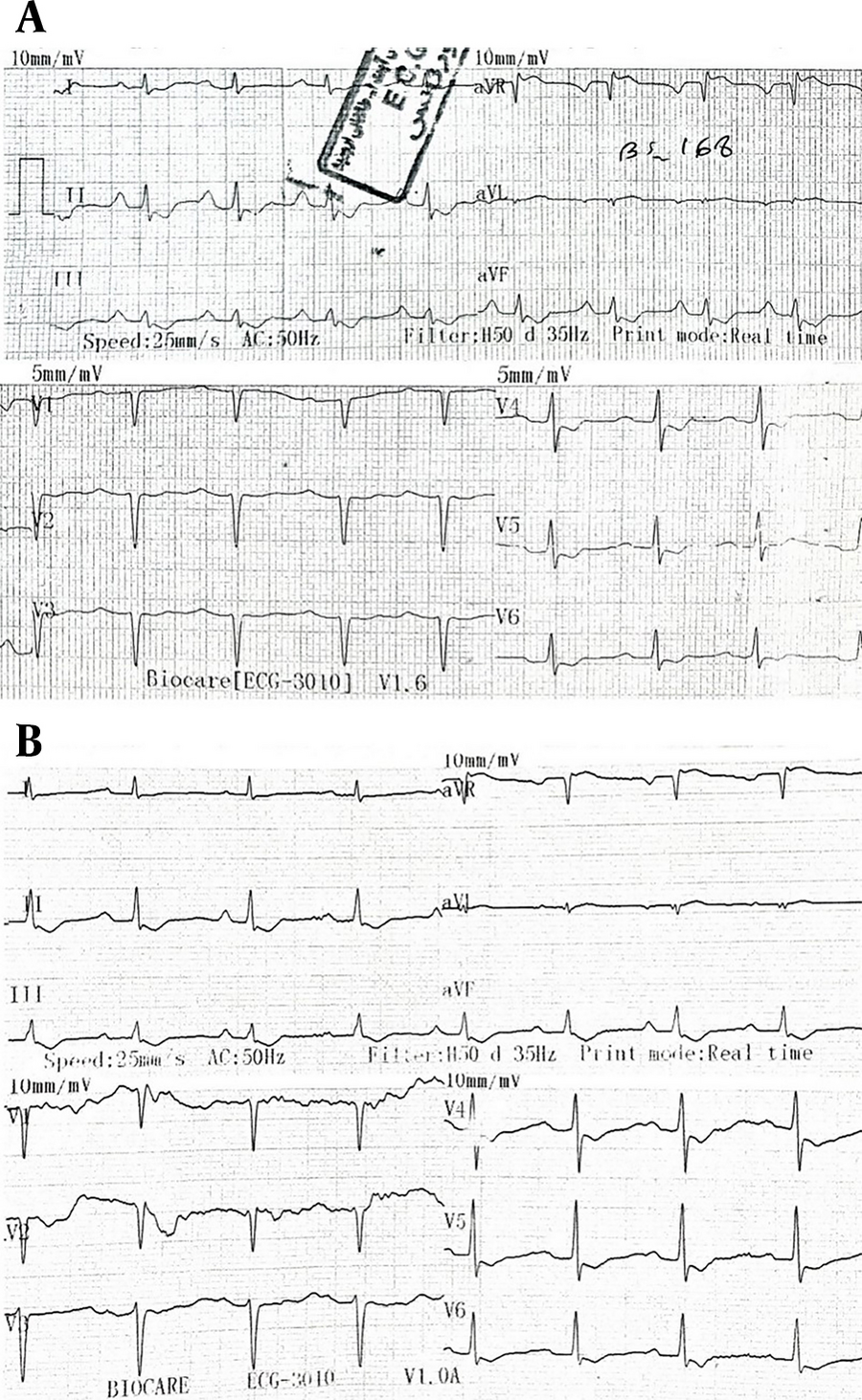 Digoxin effect — source media 2