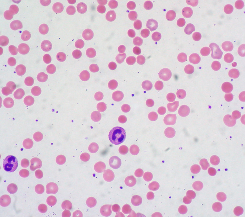 Spherocytes blood smear — source media 2