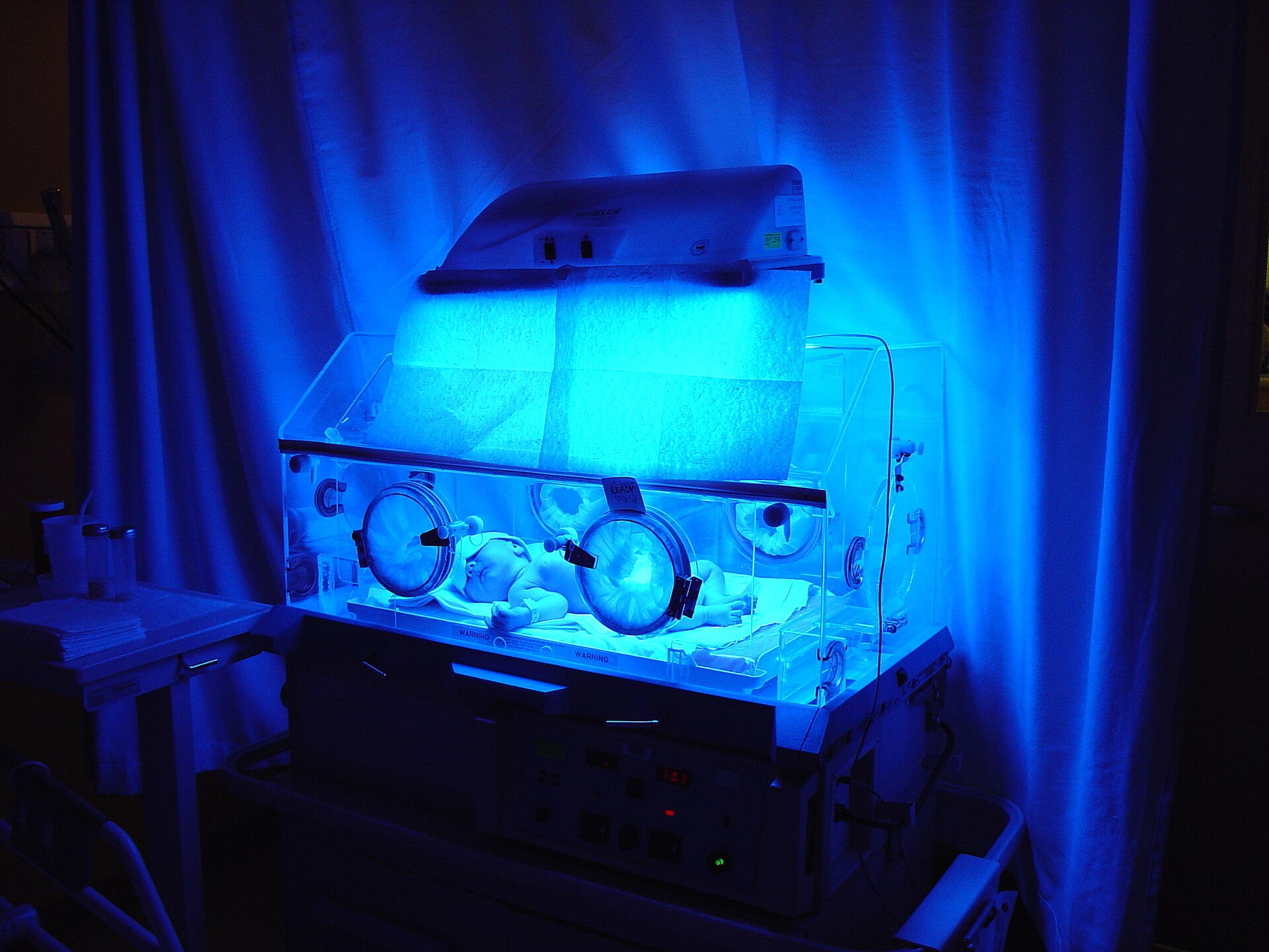 Neonatal jaundice — source media 2