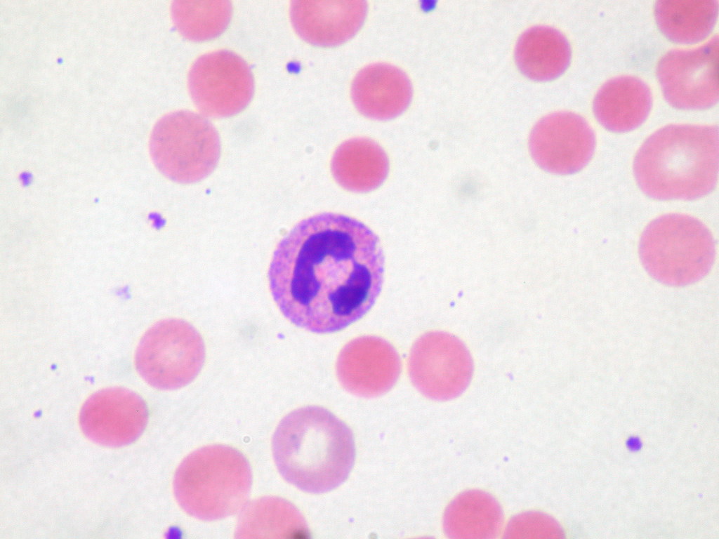 Spherocytes blood smear — source media 3