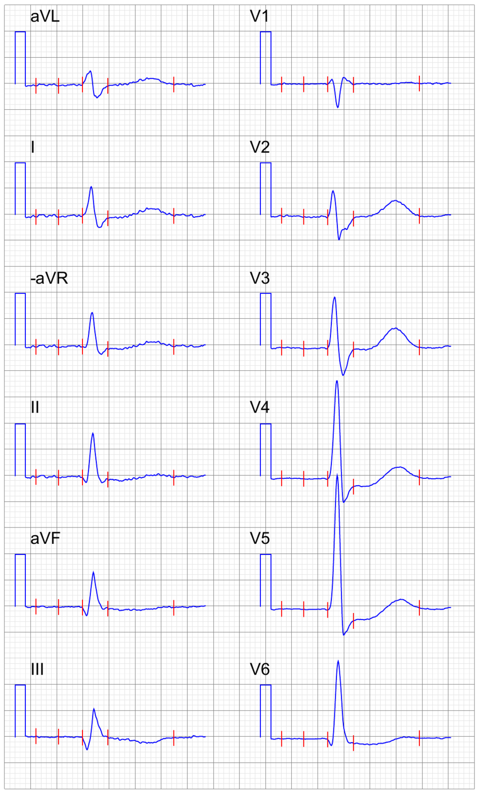 Digoxin effect — source media 3