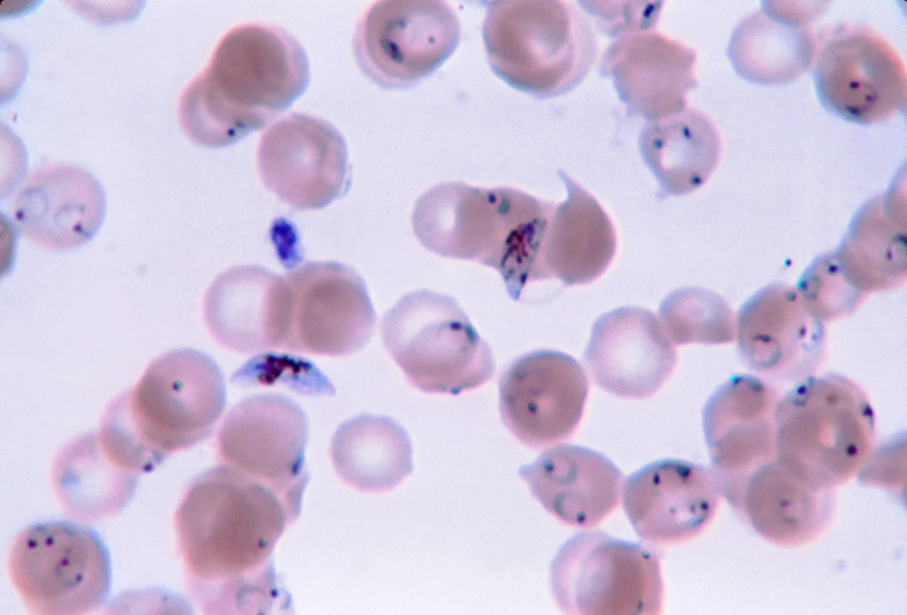 Malaria blood smear — source media 2