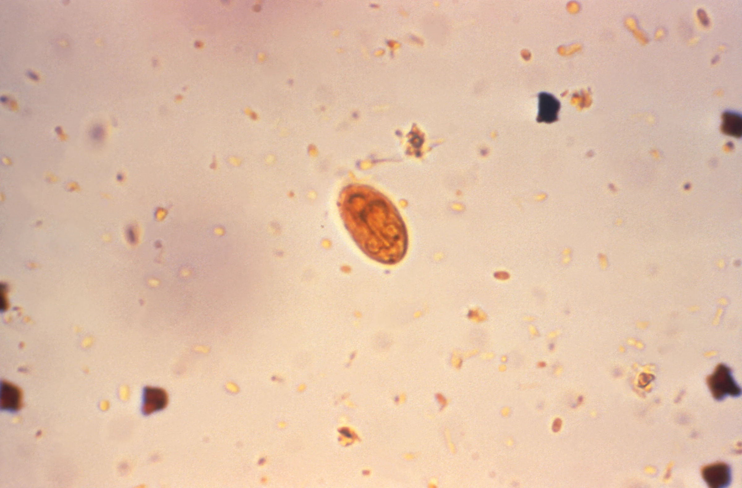 Giardia stool microscopy — source media 2