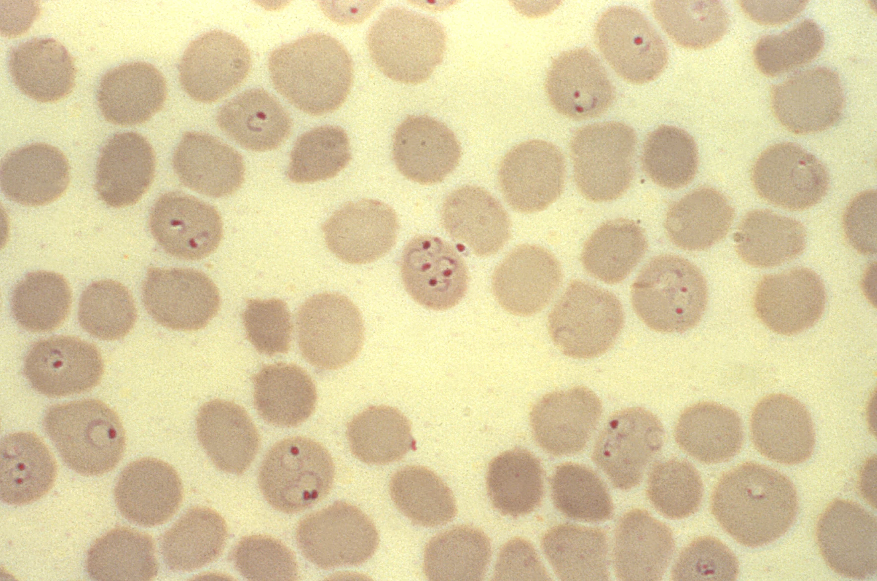 Malaria blood smear — source media 3